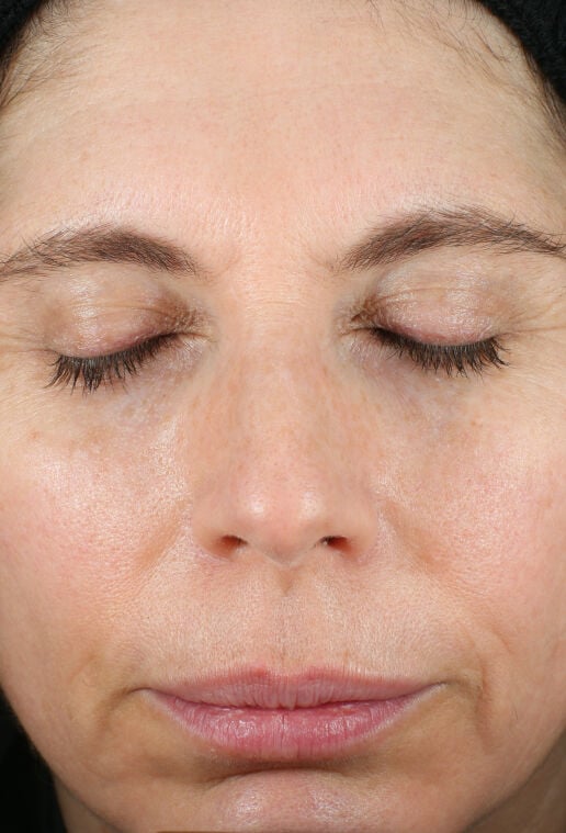 Renewal Crème | Renewal Cream For Dry Skin | ZO Skin Health, Inc.